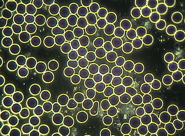 Figure 2: Normal healthy blood from female, age 37.