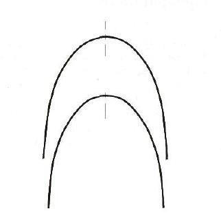 Figure 1: Tapered Archform