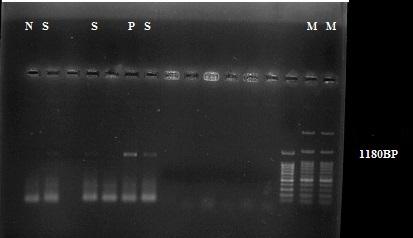 Figure 3: PCR result for SAG1gene. P: positive control, M: size marker, S: positive sample, N: negative control.