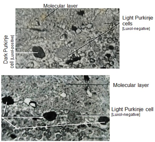 Figure 4: Survey section of cerebellar hemisphere cortex in- [a] control and [b] immobilized rat shows relatively more numbers of dark (metabolically inactive Luxol positive) Purkinje neurons in stressed rats after 24hours of restraint.