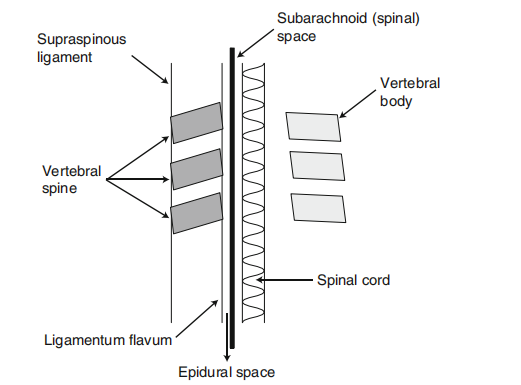Figure 2: Anatomy of spinal and epidural anesthesia.
