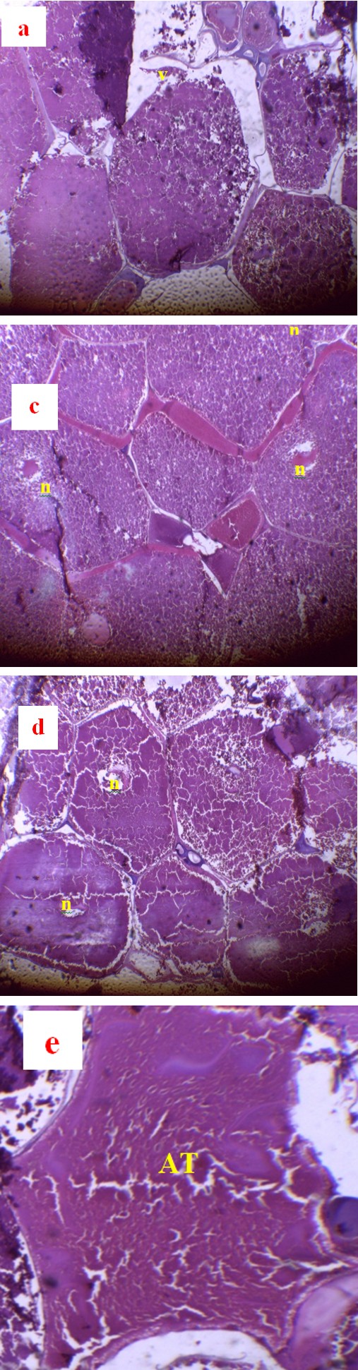 Figure 7: Gonado Somatic Index (a) and Hepato somatic Index (b) depending on the energy level of the ration Rapport Hépatho Somatique (RHS).