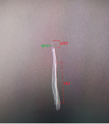 Figure 3: Radiographic Imaging of os penis in the red fox. Laterolateral view (Length of sulcus urethralis (LSU), Length of the fibrous cartilaginous tissue (LFCT), width of the fibrous cartilaginous tissue (WFCT)).