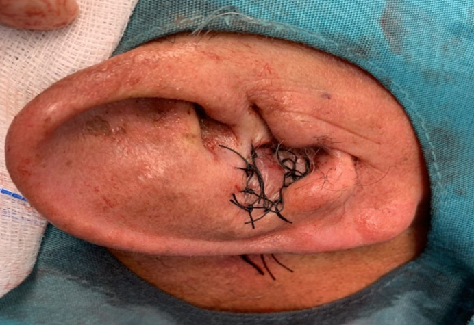 Figure 5: Anterior view of the reconstruction.