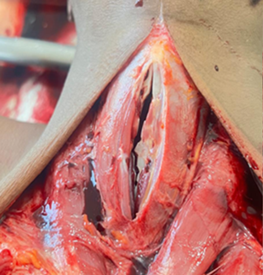 Figure 6: Cervical Region.