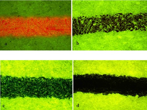 Figure 1: Shows the ink samples in B2A emission cut off filter (450-490 nm) of Fluorescence Microscope a) High Intensity fluorescence in Pentel energel BLN415 red gel b) Medium Intensity fluorescence in Agni 20 black ball c) Low Intensity fluorescence in Classmate octane blue gel d) No fluorescence observed in Reynolds racer black gel.