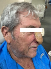Figure 7: Follow-up with no evidence of active disease.
