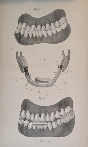 Figure 4: Mortimer WH inclined plane appliance.