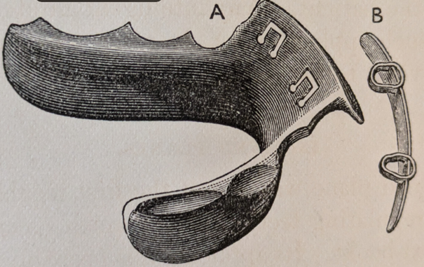 Figure 8: Kingsley NW upper sloping anterior bite plane.