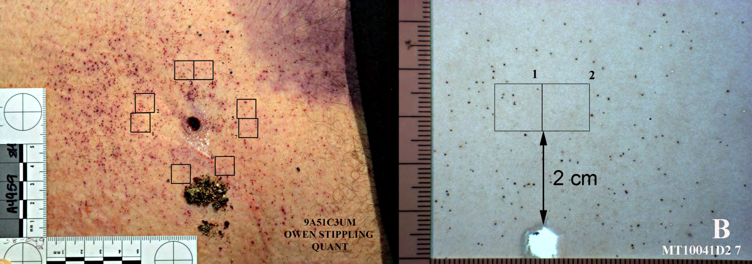 Figure 6: A. Image of the stippling around the chest wound of Adam Owen; 1-cm squares were drawn in Photoshop, 2 cm from the bullet hole margin. B. The backlit Benchkote target was shot at 4 inches (10 cm) with the test fabric over it; the same procedure as in A, but the backlit paper target accentuated the powder fragments on the Benchkote paper.