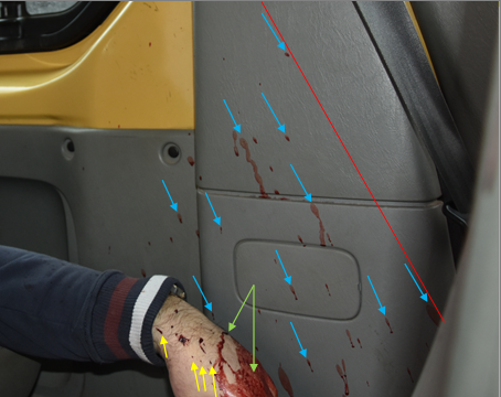 Figure 6: Blood Stains on a Plastic Mask of the Frame Behind the Driver’s Door.