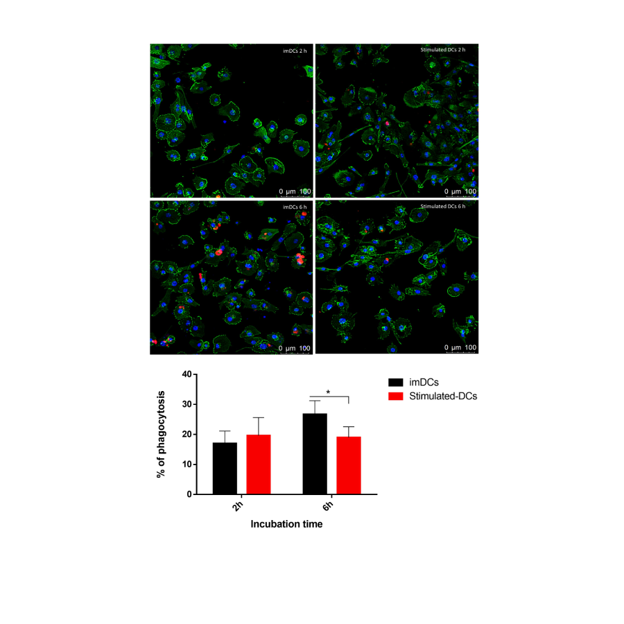 Figure 6: Capacity of DCs to phagocytose apoptotic bodies of SK-MEL-28. The microscope images depict phagocytosing apoptotic bodies SK-MEL-28. Nucleus (blue), actin (green) and apoptotic bodies (red). The data are representative of two independent experiments performed in triplicate and presented as the mean ± SD. *p<0.05 as determined by One-way analysis of variance followed by nonparametric Mann–Whitney U-test as a post-hoc test. DCs: dendritic cells.