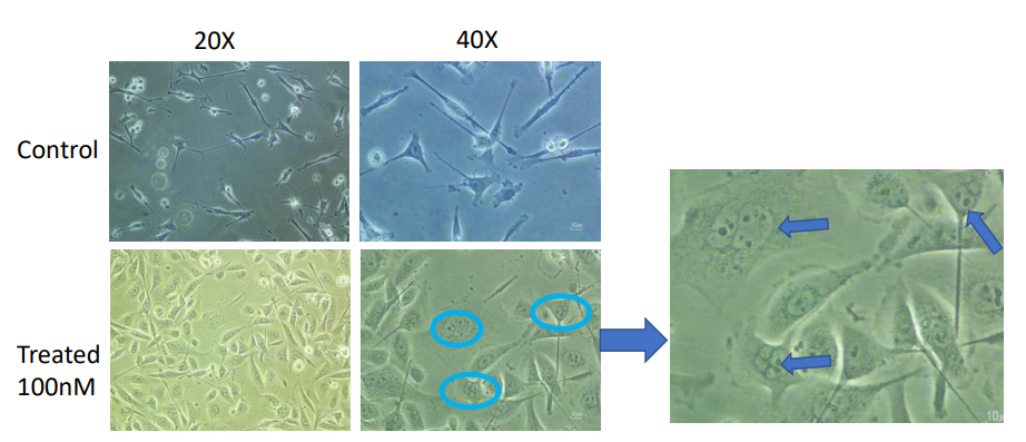 Figure 4: Development of MDA MB231 resistance cells by treatment with Cisplatin drug.