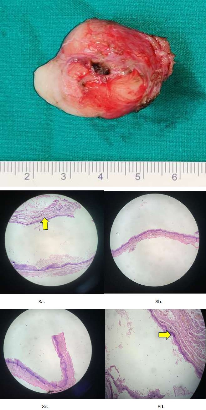 Figure 7: Main surgical specimen.