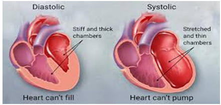 Figure 2: Heart failure is either predominantly systolic or diastolic.