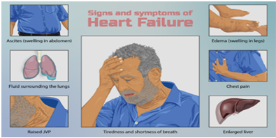Figure 3: Signs and symptoms of Heart Failure.
