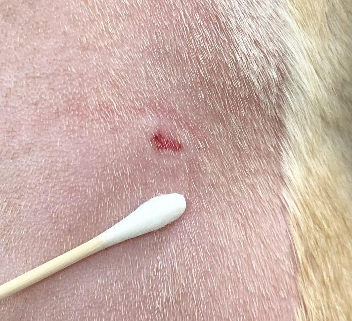 Figure 1: Demonstrates the skin lesion noted upon initial removal of the Omnipod®. Per owner communication, this lesion was resolved within 24 hours.