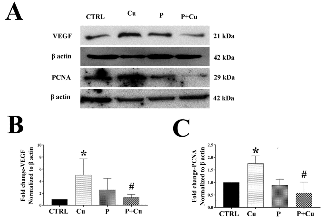 Figure 5: Effect of penicillamine on HO1 and MDM2: (A) Western blots for VEGF and PCNA with their respective β actins; (B) VEGF densitogram normalized to β actin; (C) PCNA densitogram normalized to β actin; * p < 0.05; when compared to control. # p < 0.05; when compared Cu.