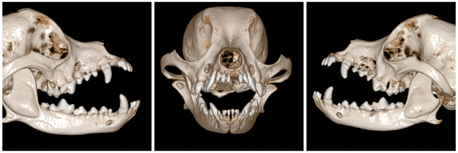 Figure 3: 3D reconstruction after cone beam computed tomography. Right lateral view, frontal view, and left view of the skull.