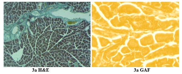 Figure 3: Photomicrographs (x 400) of pancreas of diabetic rats treated with metformin. (H&E= Haematoxylin and eosin, GAF=Gomori Aldehyde Fuschin stain)