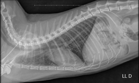 Figure 2: Chest radiograph, lateral-lateral projection. Opacification of the lung fields of mixed pattern, interstitial and bronchial, with evidence of areas of peribronchial infiltrate.