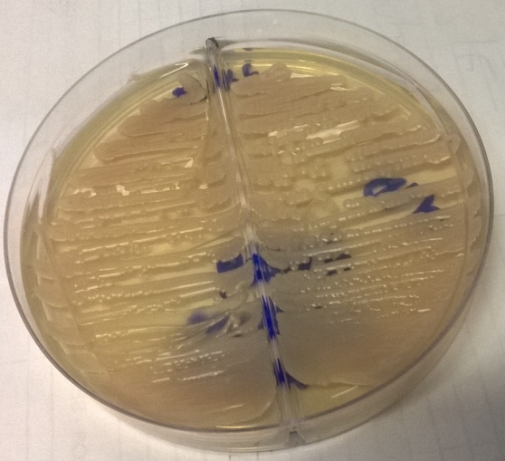 Figure 4: Growth of whitish mucoid colonies on Sabouraud dextrose agar plate with a cerebrospinal fluid sample obtained from a cat suspected of cryptococcus.