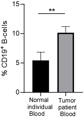 Figure 5: A graphical plot showing the rise in count of B cells in cancer patients as compared to that in a normal healthy individual. The representative bar plot is showing changes in percentage of B-cells between normal and breast tumour patient’s blood (n=3). Unpaired student’s t-test was used to evaluate statistical significance of the data using Graph Pad prism8 software.