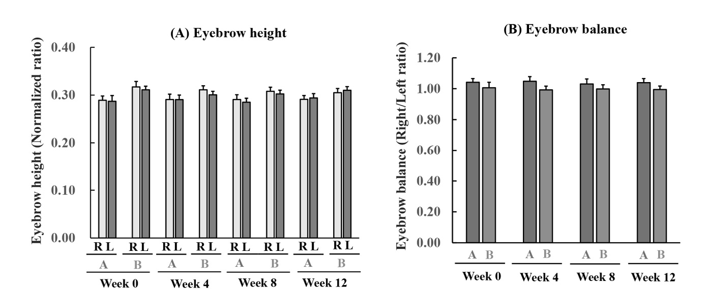 Figure 6: Changes in the right and left eyebrow heights (A) and bilateral eyebrow balance (B) after BTA injection in groups A and B. The height and balance were calculated using formulas (1) and (2). Each value represents the mean ± SEM (n = 11). No significant differences were observed between the height of right (R) and left (L) eyebrows at weeks 0 (pretreatment), 4, 8, and 12 and postoperative changes in both groups (two-way ANOVA + Mann–Whitney U test or Tukey’s multiple comparison test). No significant differences were observed in the R/L balance ratio between both groups and the postoperative changes in both groups (two-way ANOVA + Mann–Whitney U test or Tukey’s multiple comparison test).