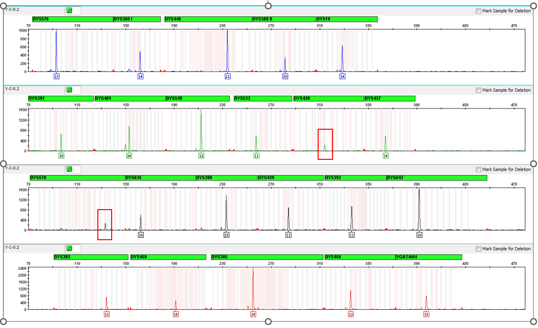 Figure 2: The Powerplex® Y23 Electropherogram Displaying Allele Drop Out from the Control DNA 2800M Sample Obtained at Concentration of 0.2 ng Template DNA.