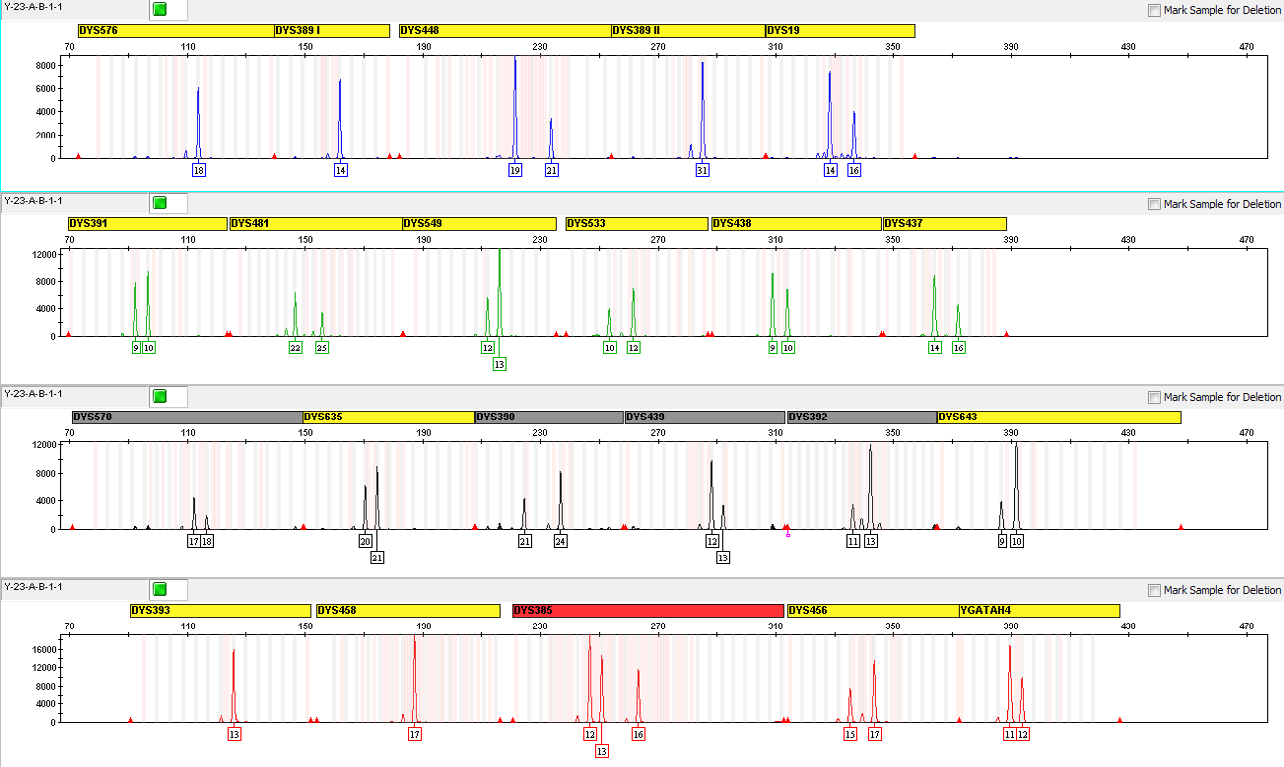 Figure 4: The Electropherogram Showing all Alleles Present in 1:1 (A:B) Input DNA Ratios of Male DNA (Case Study Sample) and Control DNA 2800M, (A- Male DNA (Case Study Sample), B- Control DNA 2800M).