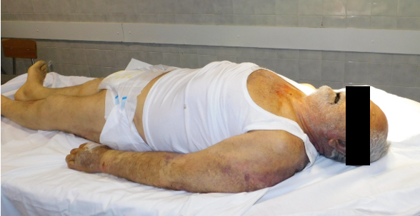 Figure 1: At First Inspection, the Yellowish Skin Color was Immediately Evident.
