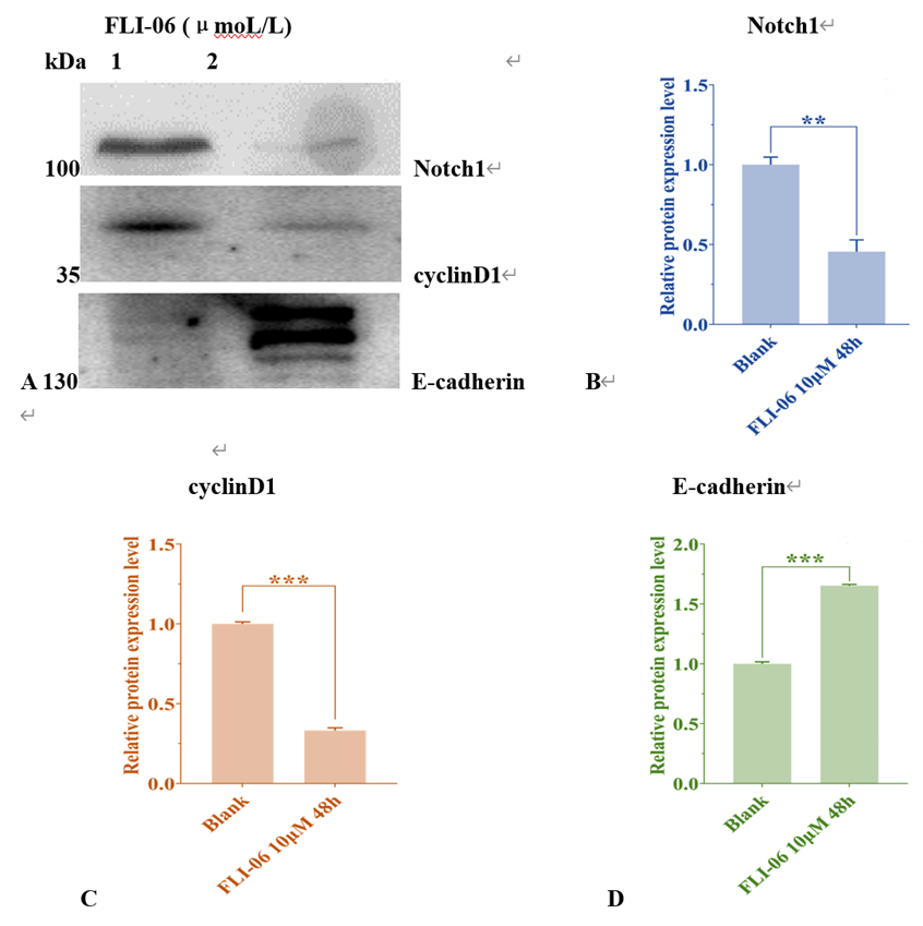 Figure 2: Expression changes of Notch1, cyclinD1 and E-cadherin proteins in AM cells treated with FLI-06 for 48h. (A) Western blot detection of the expressions of Nocth1, cyclinD1 and E-cadherin proteins (1, Blank. 2, FLI-06 10μmoL/L). (B) Gray ratio of Notch1 parameter before and after FLI-06 treatment. (C) The gray ratio of the parameters in cyclinD1 before and after FLI-06 treatment. (D) Gray ratio of E-cadherin parameter before and after FLI-06 treatment. Treatment at a concentration of 10μmol/L.
