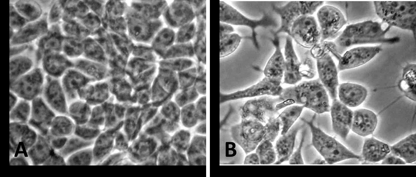 Figure 2: Photomicrograph of fluorescent-labeled galectin-3 localization in cultured MCF-7 cells. MCF-7 cells were cultured on coverslips and incubated for an additional 48 hours in a medium containing various exposures as described in the Materials and Methods. The cells treated with 10-6M tamoxifen (10-6M TAM) exhibited a shorter size with decreased galectin-3 labeling.