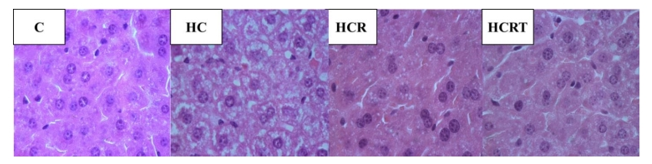 Figure 4: Photomicrograph of liver sections. C, control; HC, high-carbohydrate diet and water; HCR, high-carbohydrate diet and Rooibos tea; HCRT, high-carbohydrate diet and water for 6 weeks, followed by Rooibos tea replacing water in the last 2 weeks (n = 8 animals per group). Hematoxylin and eosin staining (H&E). Objective: 100×.
