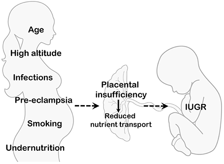 Figure 1: Pathophysiology of LBW (Maternal and Environmental Conditions).