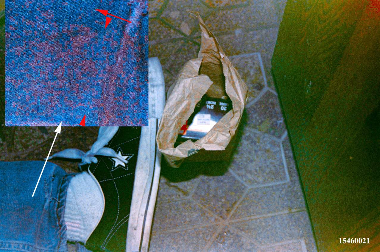 Figure 11: Left lower pant and foot of Cobain after processing (Figure 10); the image processing revealed bloodstains on the pant. Inset. Enlargement of the stained pant area showing detail; the bloodstains are in discreet islet areas. The red arrow indicates the movement direction of the fold when it overlapped the fabric, which created a partial stain void (between arrowheads).