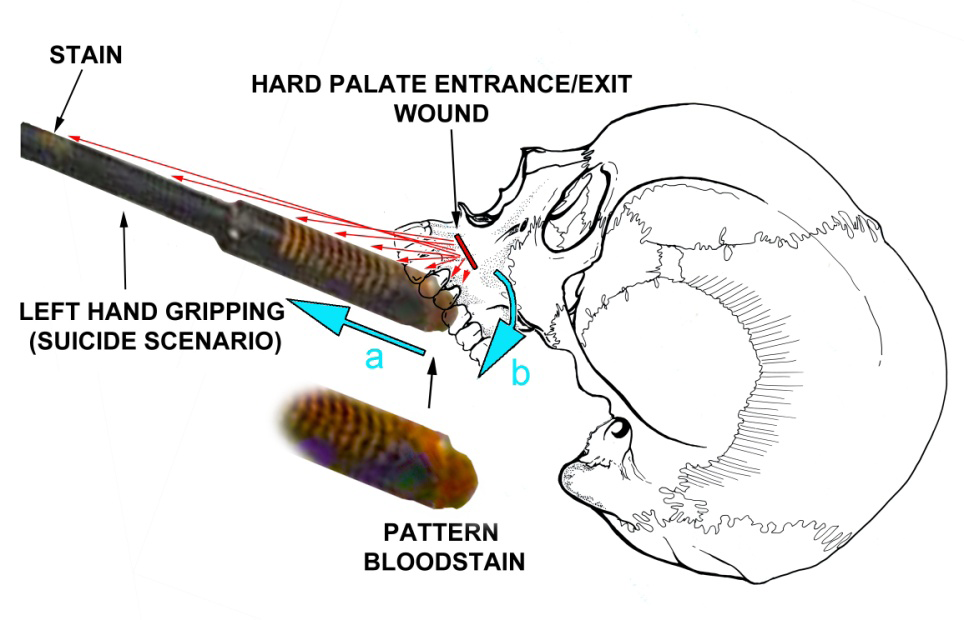 Figure 21: Graphic recreation of the shotgun recoil motion (blue arrows) in either suicide or homicide scenarios, where the retrograde motion of the recoil action (blue arrow a) there was a simultaneous rotation downward (blue arrow b) propelled by the compensator’s 90 degree gas redirect, which created the pattern bloodstain on the compensator muzzle during its retrograde and downward rotation. Backspatter was documented on the dorsal (trigger-down) shotgun compensator and barrel. The surface of the compensator on the vents and the shotgun barrel directly posterior to the compensator did not have discernible staining, indicating that it had been partly or fully rubbed off. The stain on the barrel (at “STAIN”) should not be present in the suicide scenario due to the left hand blocking spatter deposition on that part of the shotgun barrel (e.g., Figure 19C). Graphic by author BB.