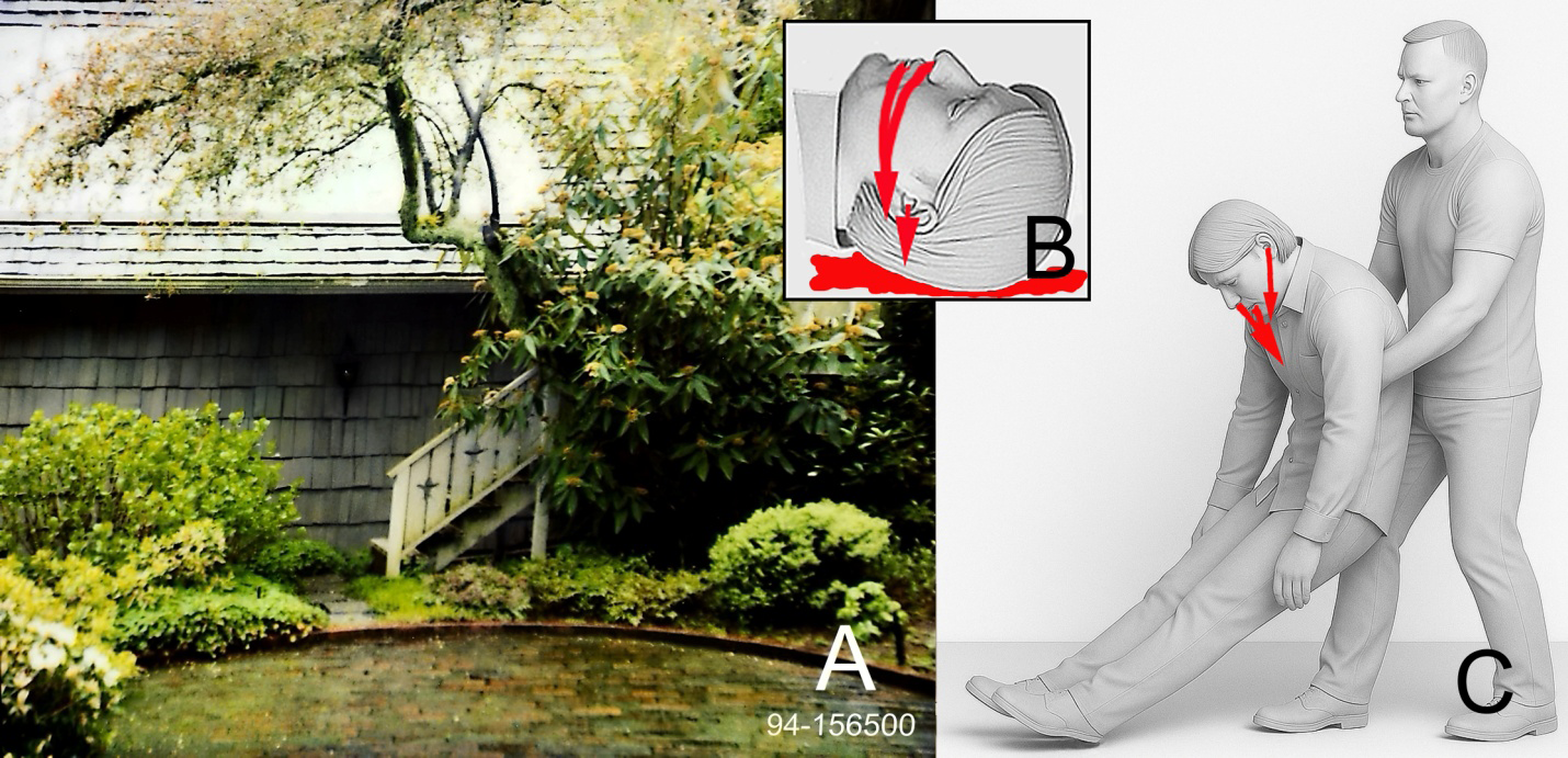 Figure 22: A. Image of the garage/greenhouse showing the stairs to the upper floor greenhouse; Cobain’s body may have been carried up these stairs to the greenhouse, if the homicide occurred at a location other than in the greenhouse. B. Simulation of the blood flow from Cobain’s mouth, nose, and ear canal if he had remained supine on the floor after the shotgun discharge; the blood would have flowed only onto the floor and would pool on the floor under his head and around it, not onto his shirts. Image from authors FN and BB. C. Simulation demonstrating the position of Cobain’s head and bleeding flow direction when his body was picked up from the floor. Any bleeding, with the shifting of his head, would be onto the front of his undershirt and shirt (indicated by arrows) which had been blood soaked (Figure 1C arrows). Following the action shown here, another assailant would have picked up Cobain’s feet, which evidence shows occurred (Figures 9&11) and his head would have remained in this position during the carrying of his body. Image from authors FN and BB.
