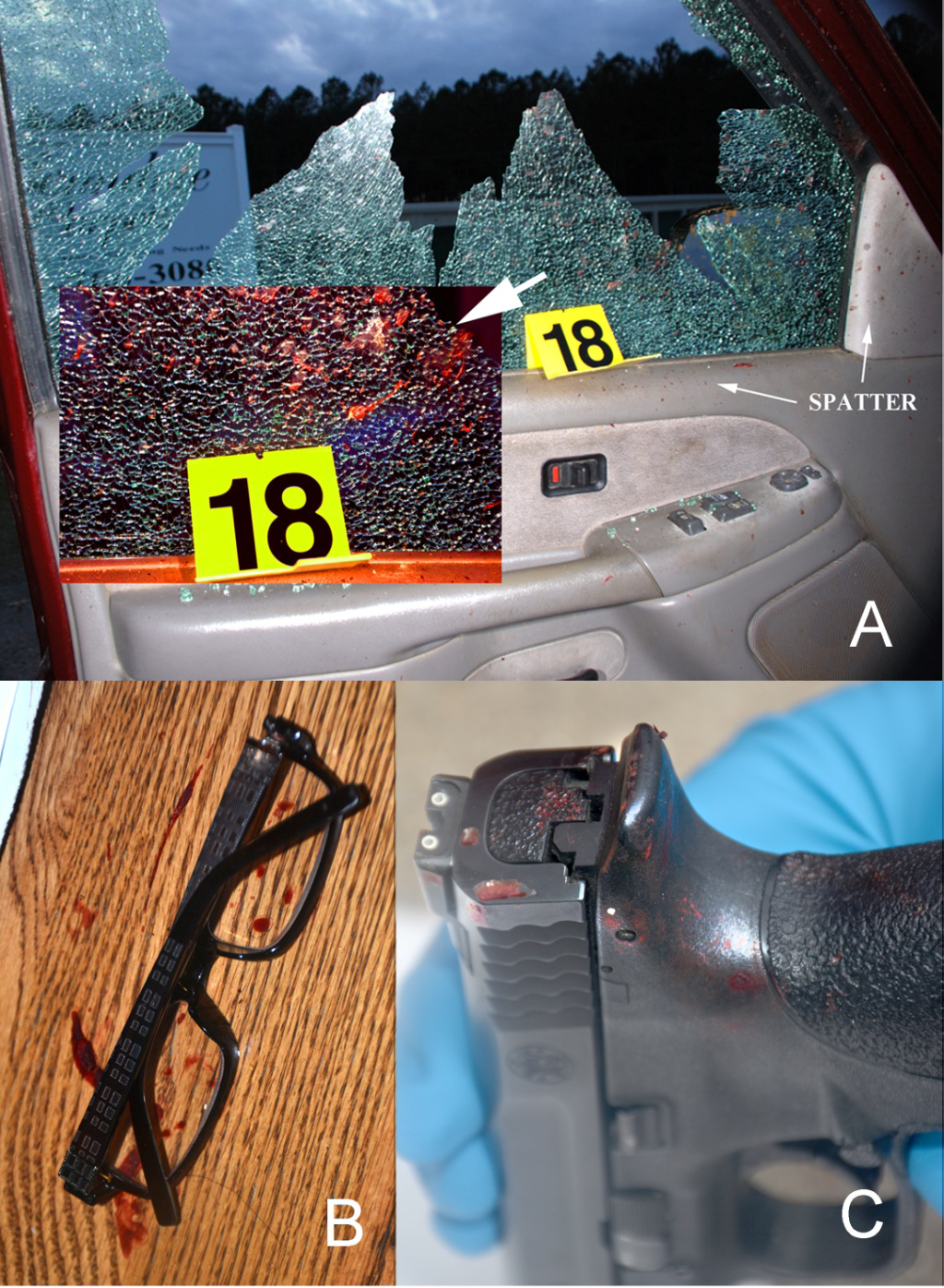 Figure 6: A. Evidence of backspatter from a head-penetrating 16-gauge shotgun discharge with muzzle contact or near-contact to the victim’s left head at his ear; the shooter had broken the vehicle window, while the door was open, from the exterior side prior to the victim being positioned by other assailants on the interior side of the door with the shooter discharging the shotgun [26]. The entrance wound was also the exit, resulting in a substantial backspatter of blood and other tissue, as shown on the fractured tempered window glass. Inset. Photoshop-enhanced close-up image of the blood and other tissue spatter on the window. Images from [26]. B. Spatter on the glasses of the shooter; the muzzle of his 10 mm pistol was at contact or near contact on the victim’s head when it discharged. The backspatter covered him as evidenced by the spatter on his glasses. Image from author BB. C. The 10 mm pistol used by the shooter in the same case as B; in the assailant’s rush to clean off blood on himself and the pistol, he neglected to thoroughly clean the pistol where he had transferred blood to the rear of the pistol. Image from author BB.
