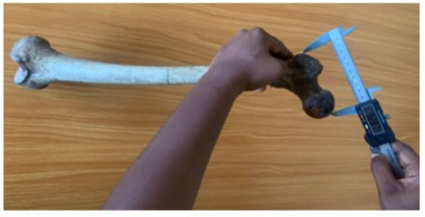 Figure 2: Measurement of proximal of femur.