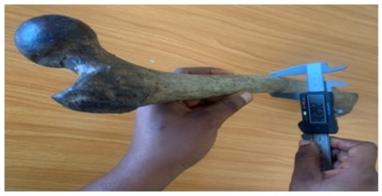 Figure 5: Measurement of middle transverse diameter of femur.