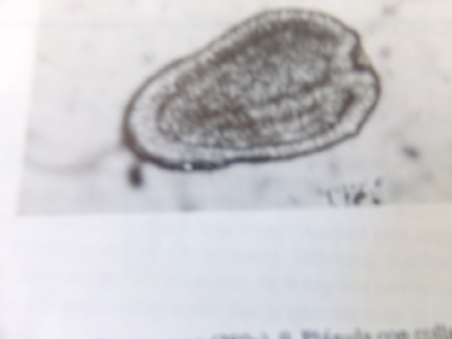 Figure 1: Larvae is characterized for having a collar and an apical tuft.