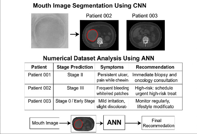 Figure 2: The result in CT scan images in mouth cancer detection and the numerical dataset.