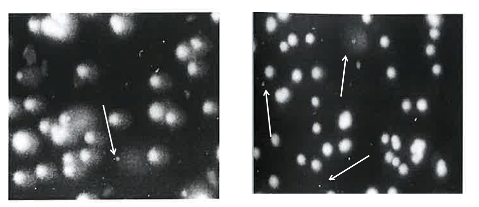 Figure 1: Microscopic image showing cell death in the diffusion and comet assays Left, Ghost images; right, Halo image.
