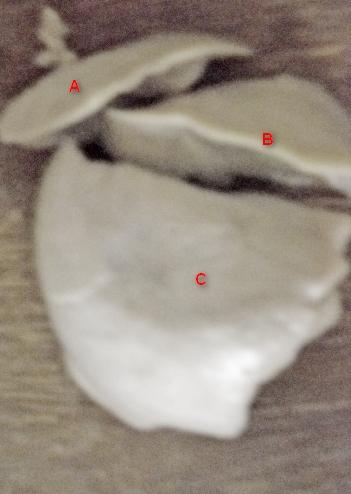 Figure 10: Photograph of camel right lungs at middle third trimester showing clear demarcation between the various segment of the right apical lobe (A), right middle lobe (B) and right caudal lobe(C) x 125.
