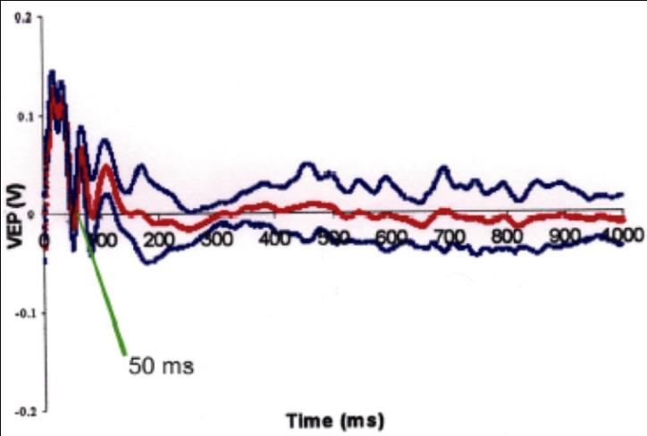 Figure 10: Flash VEP on normal group. Latency time=50msec.}