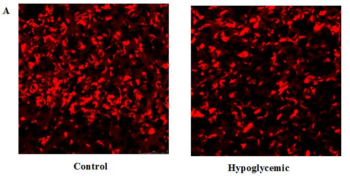 Figure 5: Real Time PCR analysis of Akt-1 and NF-κB mRNA expression in the cerebral cortex of experimental rats. Values are mean ± S.E.M. of 4–6 separate experiments. Each group consists of 4–6 rats. a p<0.001 when compared to control.