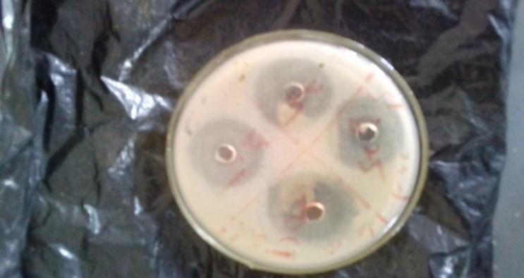 Figure 4: Showing antibacterial activity of _Ceasalpiniapulcherrima_ stem bark against _Escherichia coli._ The crude methanol, ethyl acetate, N-hexane, Dichloro- methane extract of the leaf and stem bark of _Caesalpiniapulcherrima_ were qualitatively and quantitatively tested for the presence of the components, such as alkaloids, cardiac glycoside, steroids, anthraquinine, phenol, tannins, saponin, flavonoids, reducing sugars, oxalate and phytate and the results were given in Table 3 below. Table 3, represent a summary of the qualitative phytochemical analysis of methanolic extract of _Caesalpiniapulcherrima_ leaf and stem bark for the presence of alkaloids, cardiac glycoside, steroids, anthraquinones, phenol, tannins, saponins, flavonoids, and reducing sugar. The methanolic extract of the leaves of _Caesalpiniapulcherrima_ possess alkaloids, anthraquinones, tannins, saponins, and reducing sugar, but doesn’t possess cardiac glycoside, steroids, phenols, and flavonoids. The bark possess alkaloids, cardiac glycosides, tannins, saponins and reducing sugar, whereas the methanolic extract of the bark doesn’t possess steroids, anthraquinones, phenols, and flavonoids. In Table 4, the ethyl acetate extract of _Caesalpiniapulcherrima_bark possess all the phytoconstituent except for steroids where it either possess it or not. The ethyl acetate extract of the leaves of _Caesalpiniapulcherrima_ possess cardiac glycosides, anthraquinones, phenols, tannins and saponnins but doesn’t possess alkaloids, steroids, flavonoids and reducing sugar. Table 5, shows qualitative phytochemical analysis of Dichloromethane extract of _Caesalpiniapulcherrima_ leaf and stem bark for the presence of the 9 phytoconstituents. The leaves and stem bark possess alkaloids, steroids, phenols, saponins, flavonoids and reducing sugar. The bark doesn’t contain cardiac glycosides and the leaves also do not contain anthraquinones and tannins phytoconstituents.