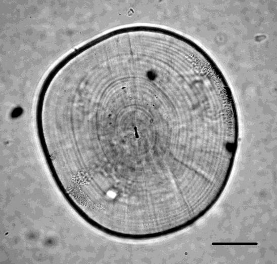 Figure 1: Laboratory-reared larval and juvenile climbing perch Anabas testudineus. a) Newly hatched larva (1.8- mm BL); b) preflexion larva, day1 (2.7-mm BL); c) preflexion larva, day2 (3.1-mm B); d) preflexion larva, day3 (3.7-mm BL); e) preflexion larva, day4 (4.4-mm BL); f) preflexion larva, day5 (4.7-mm BL); g) flexion larva, day6 (4.9-mm BL); h) flexion larva, day7 (5.0-mm BL); i) flexion larva, day8 (5.5-mm BL); j) flexion larva, day10 (5.9-mm BL); k) postflexion larva, day13 (6.4-mm BL); l)postflexion larva, day16 (7.5-mm BL); m) juvenile, day19 (8.3-mm BL); n) juvenile, day26 (12.7-mm BL). Figure modified from Morioka et al. (2009)[11].