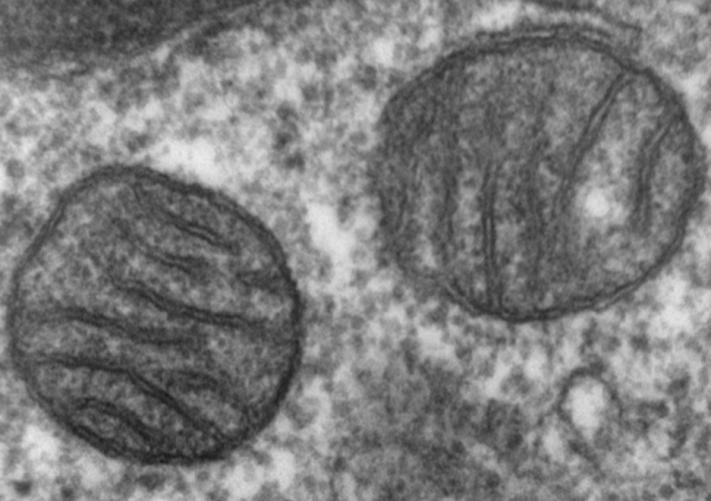 Figure 3: Mitochondria in cancer cell.